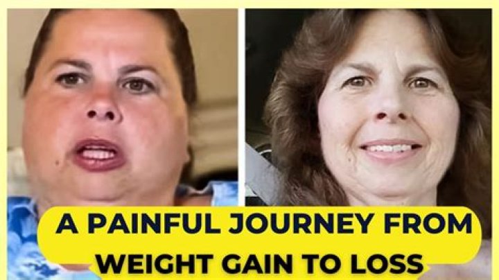 Barbara Mcquades Weight Loss Journey